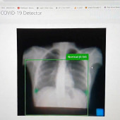 Szybka detekcja COVID-19 oparta na promieniowaniu rentgenowskim z użyciem Raspberry Pi