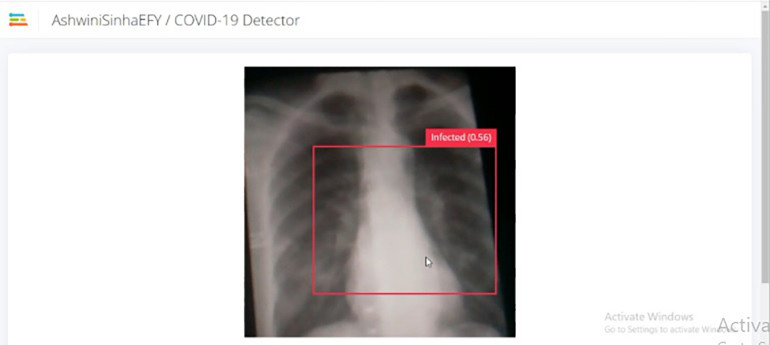 Rysunek 21. Wykrywanie zainfekowanego płuca na podstawie obrazu rentgenowskiego
