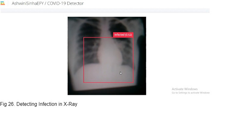 Rysunek 23. Wykrywanie infekcji na zdjęciu rentgenowskim
