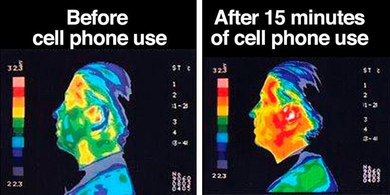Wpływ promieniowania telefonu komórkowego na głowę człowieka po 15 minutach rozmowy telefonicznej