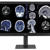 Innowacyjny monitor diagnostyczny 32HQ713D firmy LG Electronics
