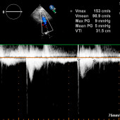 Czy Doppler był gigantem?