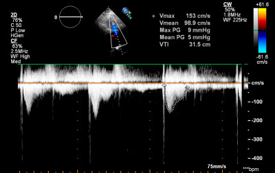 Czy Doppler był gigantem?