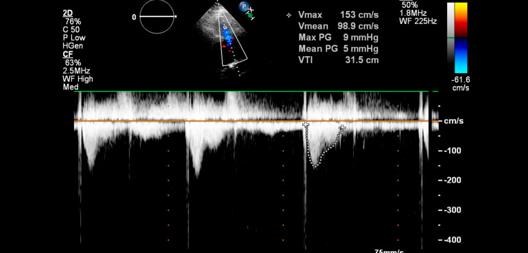 Czy Doppler był gigantem?