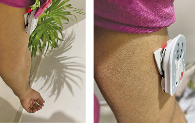 Mały i podręczny monitor zdrowia z funkcją Internetu Rzeczy