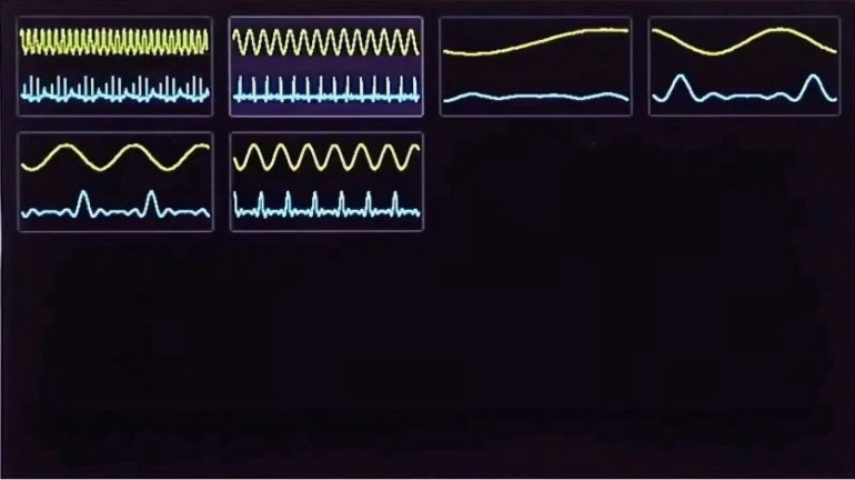Opcja menu „Przeglądanie obrazów”