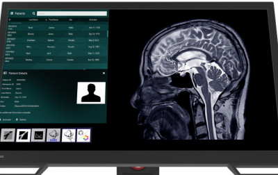 Najnowszy monitor dotykowy CuratOR LX2420-T firmy EIZO do zastosowań w radiologii interwencyjnej i na salach operacyjnych